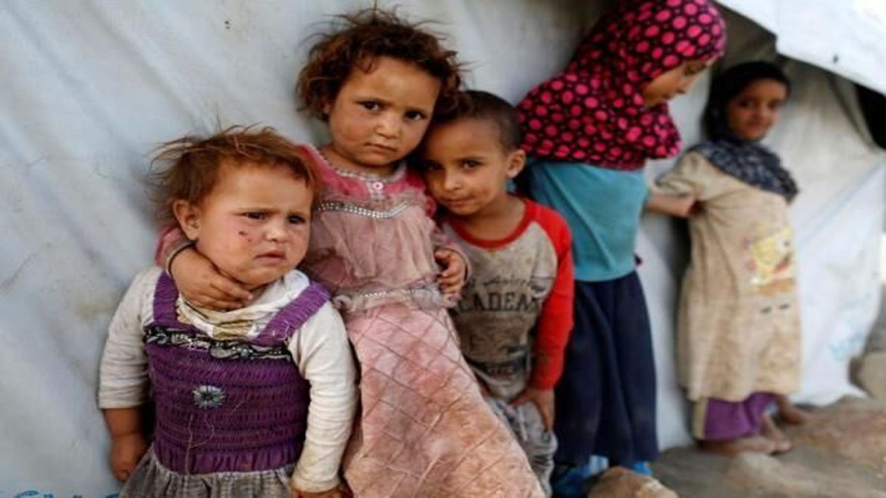 هشدار یونیسف درباره سوء تغذیه شدید کودکان یمنی