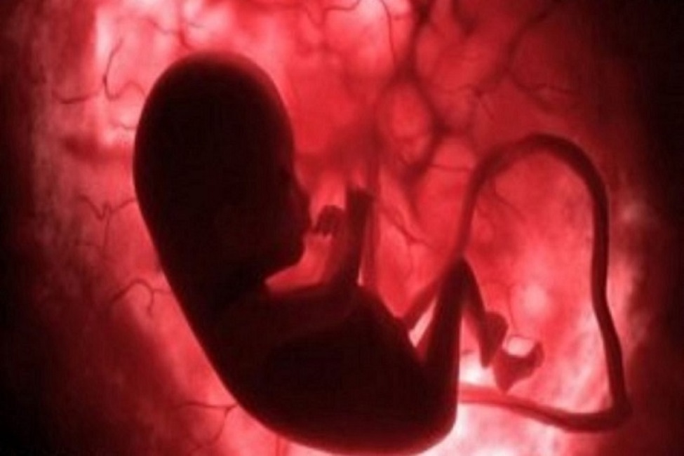 تاثیر سن پدر بر ناهنجاری‌های ژنتیکی جنین