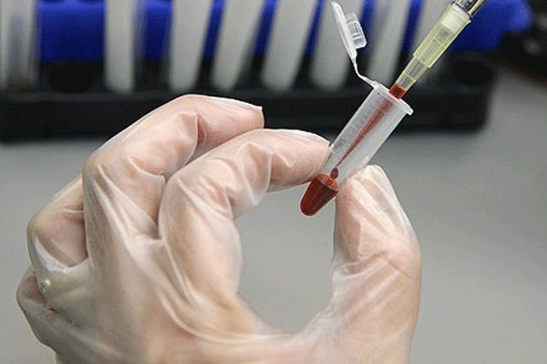 ذخیره سازی 300 نمونه خون بند ناف در استان قزوین طی سال جاری